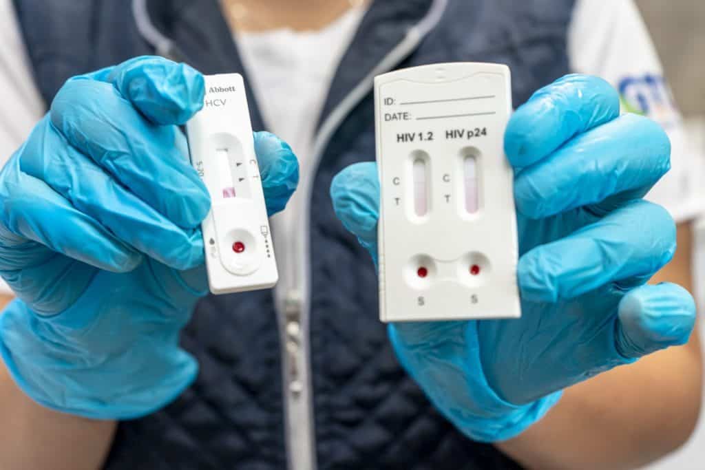 Prueba rápida de VIH y hepatitis con kits de diagnóstico en mano, atención médica y salud sexual.